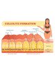 celulite skin and healthy skin