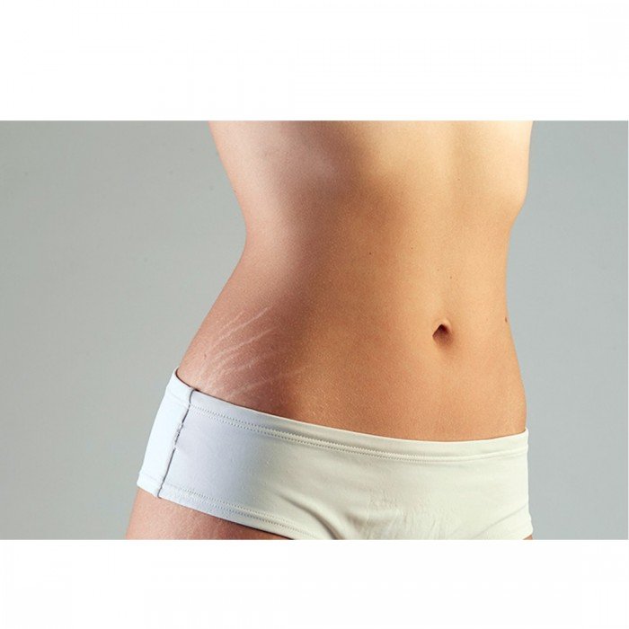 scar-cream-lifestyle-image