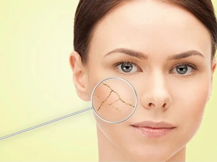 Aromatherapy Creams image